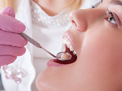 Oxnard Dental Group | Dental Cleanings, LANAP reg and Invisalign reg